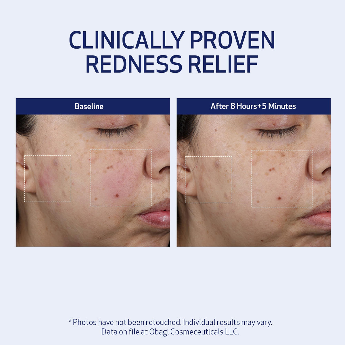 Obagi SUZANOBAGIMD ingredient complex highlighting hyaluronic acids and peptides for elasticity