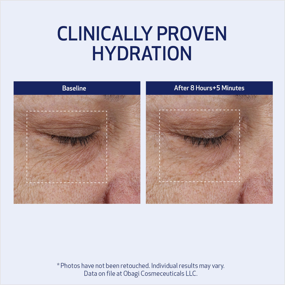 Obagi SUZANOBAGIMD applied in nighttime routine showing repair and hydration overnight
