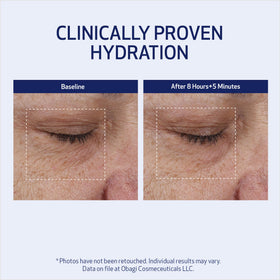 Obagi SUZANOBAGIMD applied in nighttime routine showing repair and hydration overnight