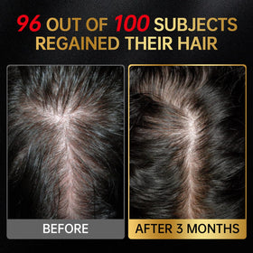 OCSINL being applied to scalp showing targeted coverage and root contact benefit