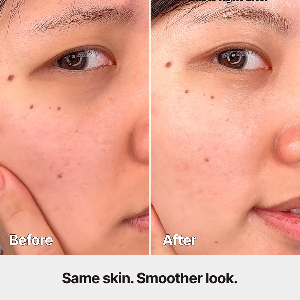 ODELOI serum absorbed into skin illustrating fast absorption and plumpness