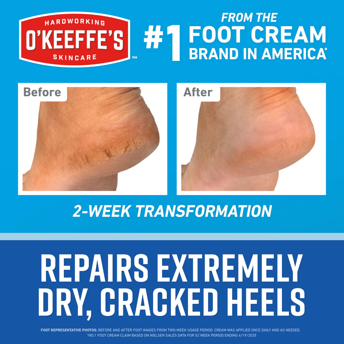 O'Keeffe's before and after two-week results illustrating visible improvement