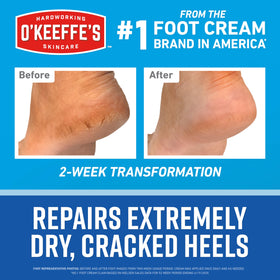O'Keeffe's before and after two-week results illustrating visible improvement