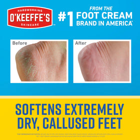 O'Keeffe's close-up label highlighting active ingredients to inform user of exfoliating benefits