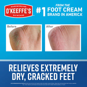O'Keeffe's cream applied to heel demonstrating targeted foot repair