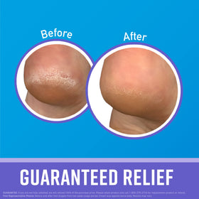 O'Keeffe's applying hand cream demonstrating overnight hydration benefit