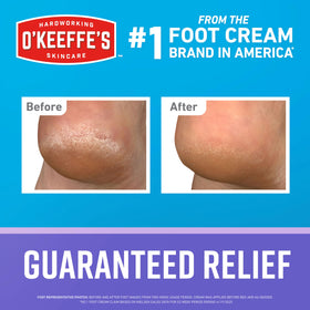 O'Keeffe's Lip Repair night balm stick detail for smooth, overnight lip hydration