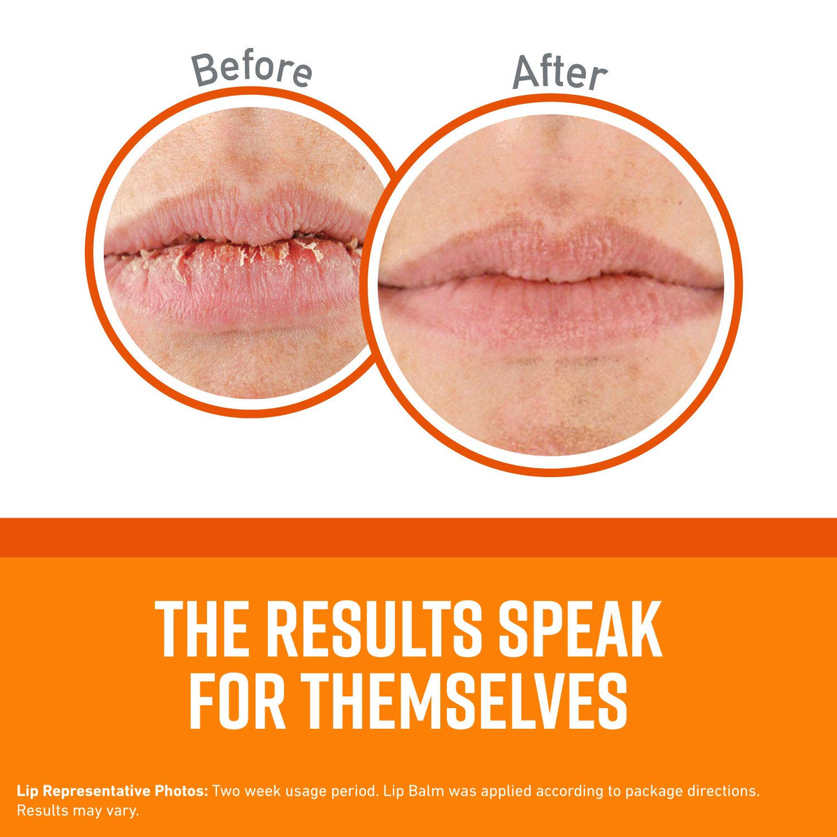 O'Keeffe's lip repair stick close-up on lips demonstrating smooth, fast absorption benefit