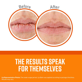 O'Keeffe's lip repair stick close-up on lips demonstrating smooth, fast absorption benefit