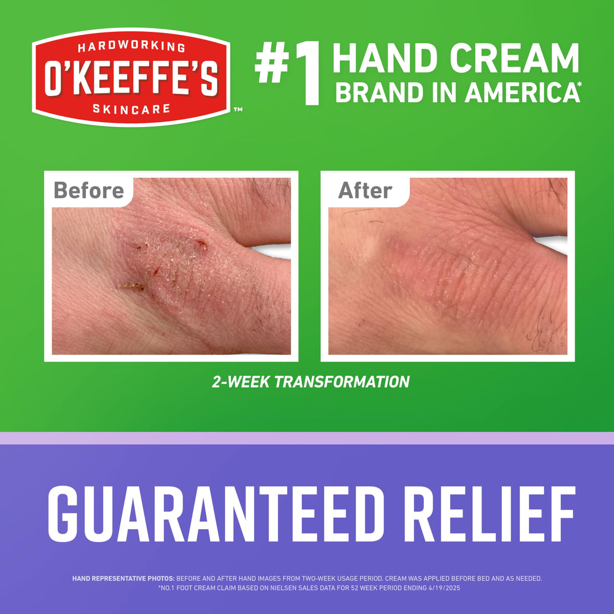 O'Keeffe's tube cap and nozzle detail for easy precise application