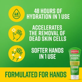 O'Keeffe's cream being applied to callused hand for softening