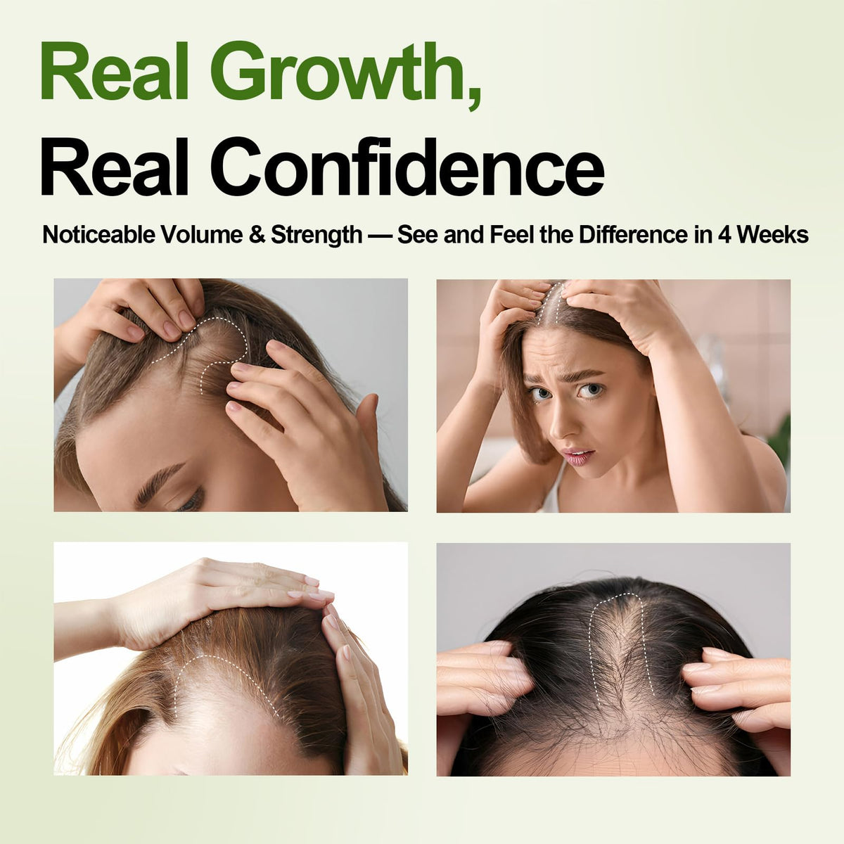 Olassubd foam applied to scalp showing targeted root nourishment