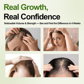 Olassubd foam applied to scalp showing targeted root nourishment