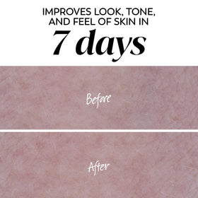 Olay pad in use on face illustrating easy three-step washing benefit