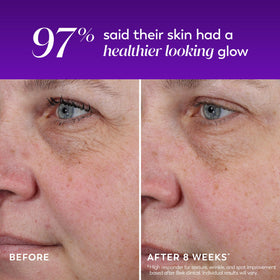 Olay nightstand scene showing bedtime use for overnight skin renewal