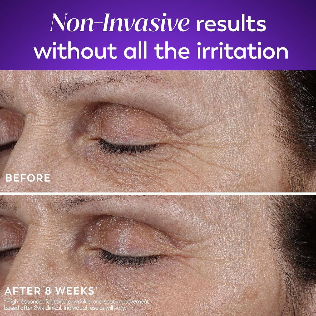 Ingredients label on Olay box, displays key actives like Pro-Retinol and niacinamide