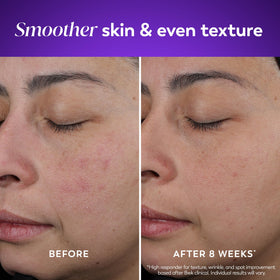 Olay open jar revealing interior cream and easy-to-scoop consistency benefit