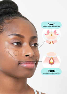 OLIVE YOUNG patch adhered to cheek demonstrating protective coverage