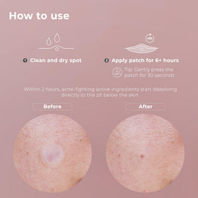 OMMA patch in bedside routine setting illustrating easy overnight application benefit