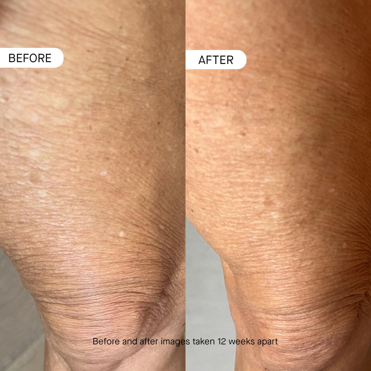 oneskin close-up of lotion texture, showing smooth absorbent peptide formula
