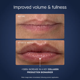oneskin label close-up showing ingredient info and fragrance-free benefit