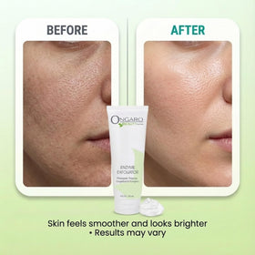 Ongaro Beauty with pumpkin pineapple papaya grapefruit illustrating natural enzymes