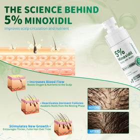 ONIADBA being applied to scalp to target thinning areas and boost confidence
