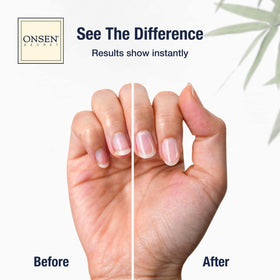 Onsen Secret cuticle serum bottle closeup highlighting nourishing formula benefit