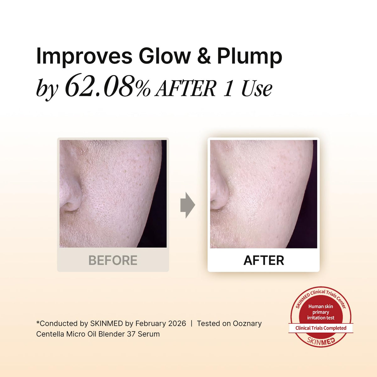 OOZNARY dropper dispensing micro oil serum for precise application