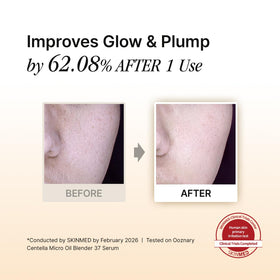OOZNARY dropper dispensing micro oil serum for precise application