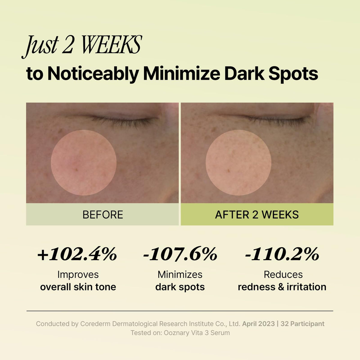 OOZNARY dispensing serum from dropper into palm for easy application benefit