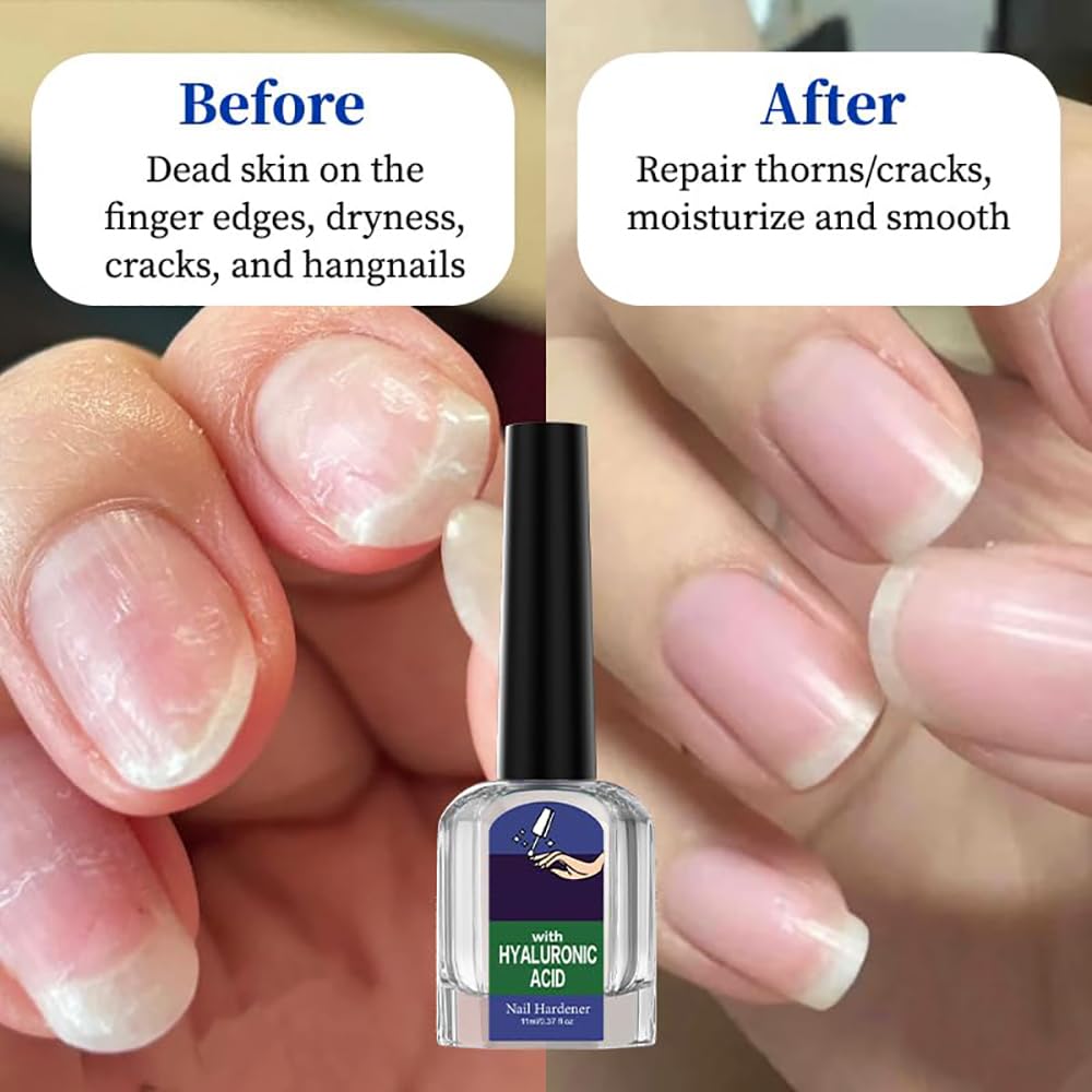 Oprtuisi dropper tip close-up highlighting precision application and control