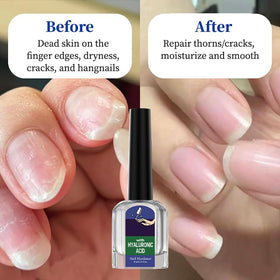 Oprtuisi dropper tip close-up highlighting precision application and control