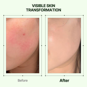 Orien being applied to skin demonstrating quick absorption and hydration