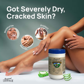 Original Udder Balm rubbed into cracked heels for deep repair benefit