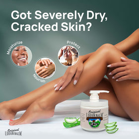 Original Udder Balm on feet demonstrating heel repair and smoother skin results