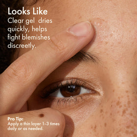 Origins ingredient visual for salicylic acid emphasizing pore-clearing action