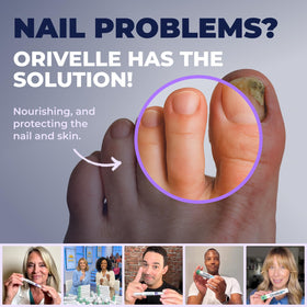 Orivelle pen held in hand for size comparison and easy portability