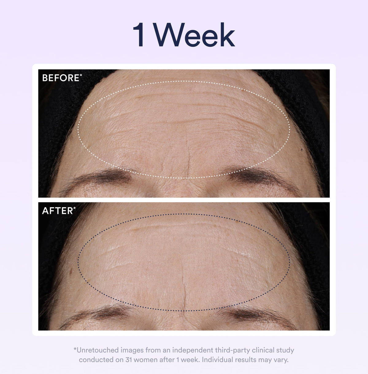 OSEA illustrative before and after concept showing visible smoothing and firming benefit