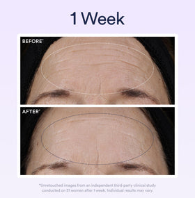 OSEA illustrative before and after concept showing visible smoothing and firming benefit