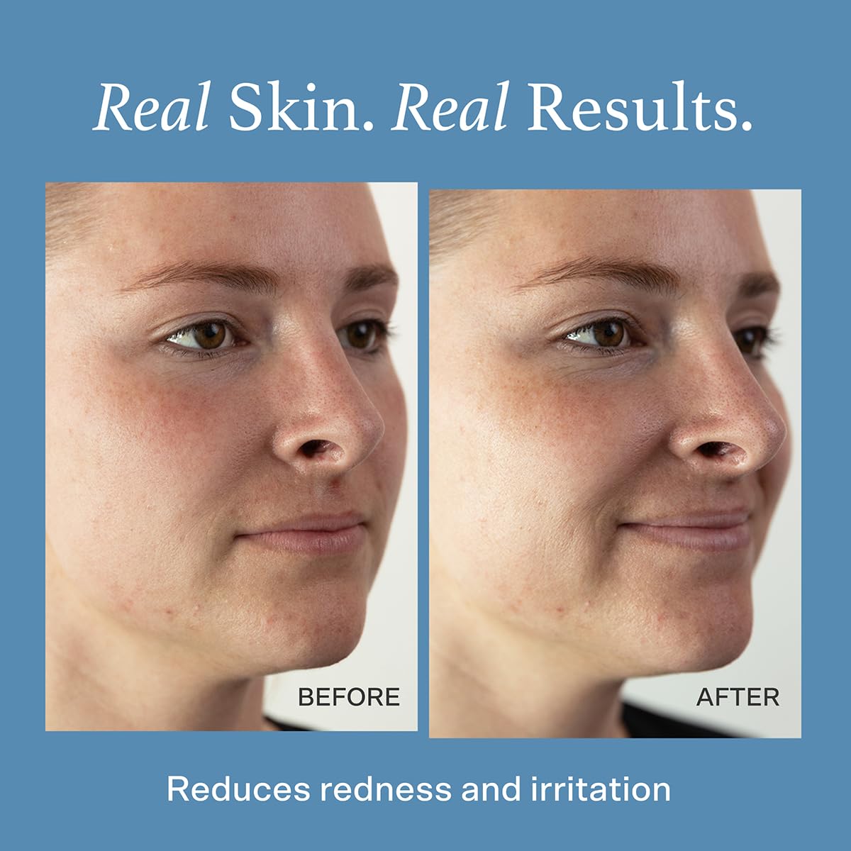 Otella fine mist close-up spray demonstrating even coverage and gentle application benefit