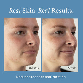 Otella fine mist close-up spray demonstrating even coverage and gentle application benefit