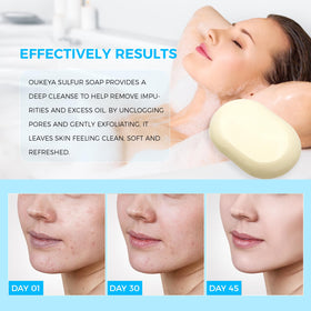 OUKEYA lathered soap in hand demonstrating easy cleansing