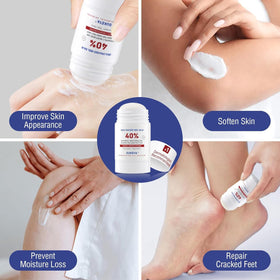 OUKEYA being applied to heel showing targeted relief for cracked skin