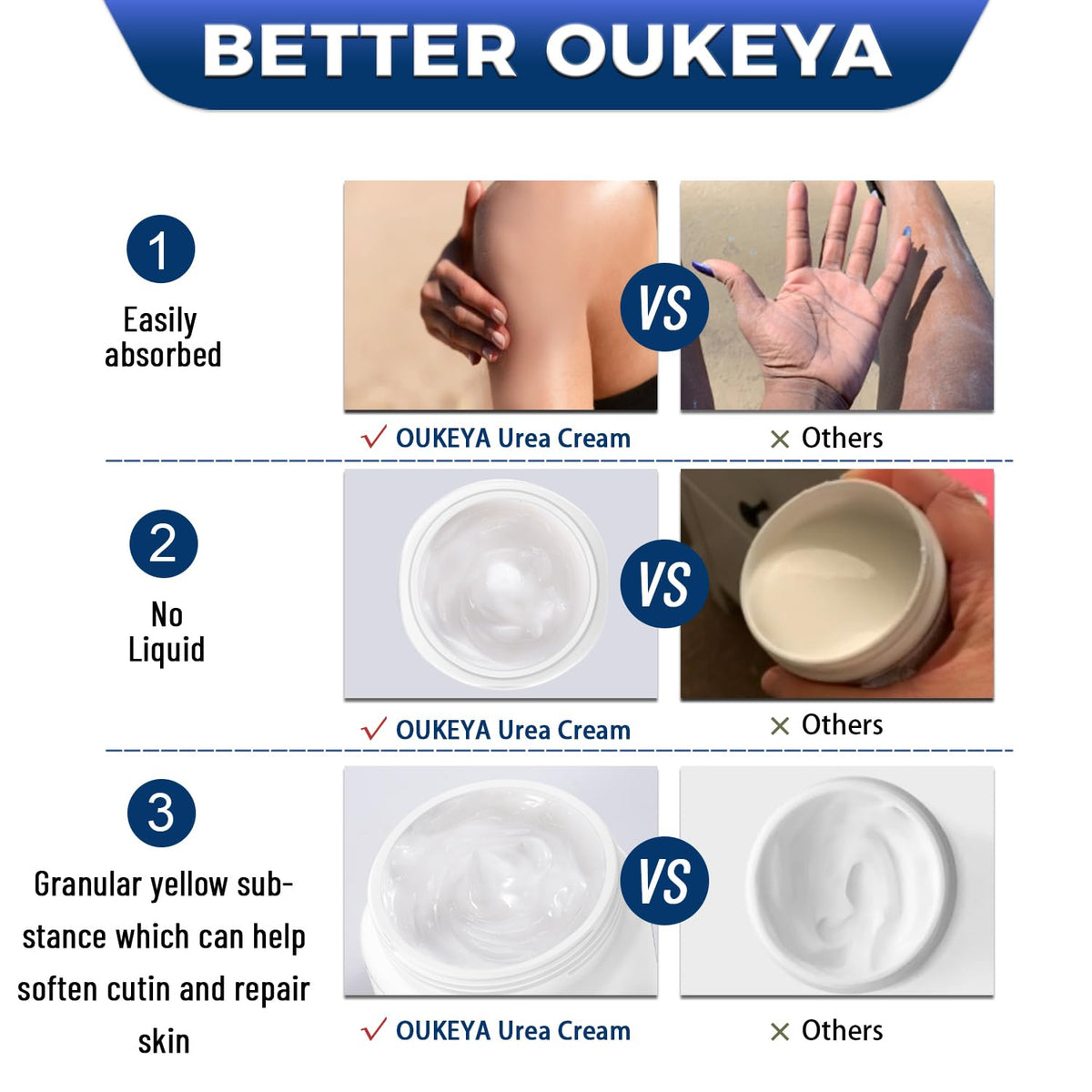 OUKEYA concept before and after callus improvement visualization
