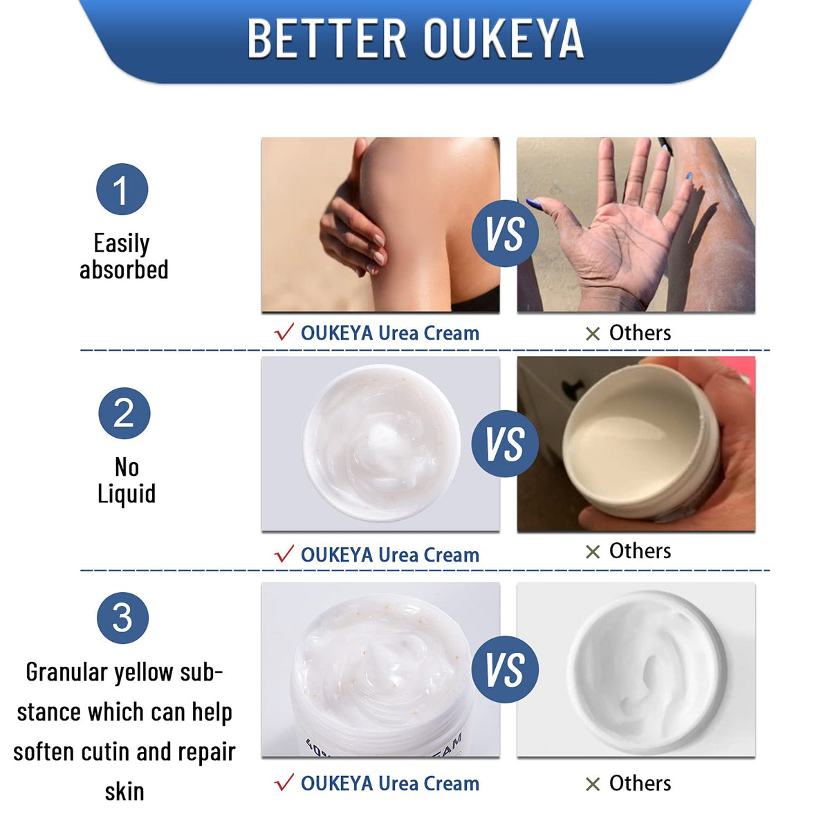 OUKEYA applying cream to heel to soften calluses and reduce cracks