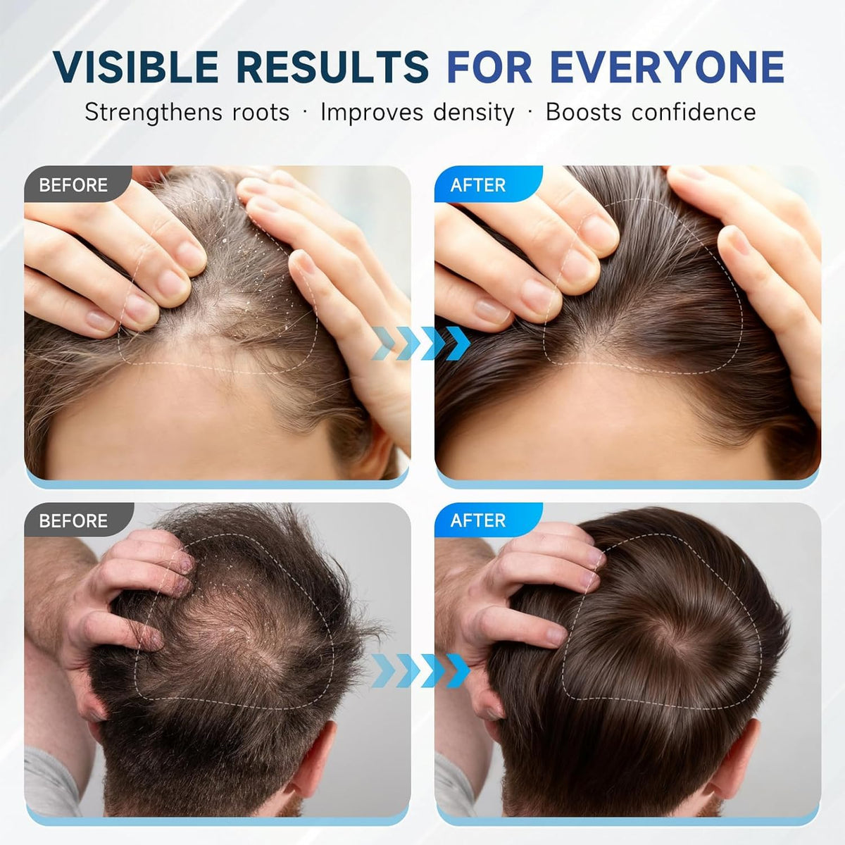 OVEXLIO label close-up highlighting biotin and rosemary benefits for scalp support
