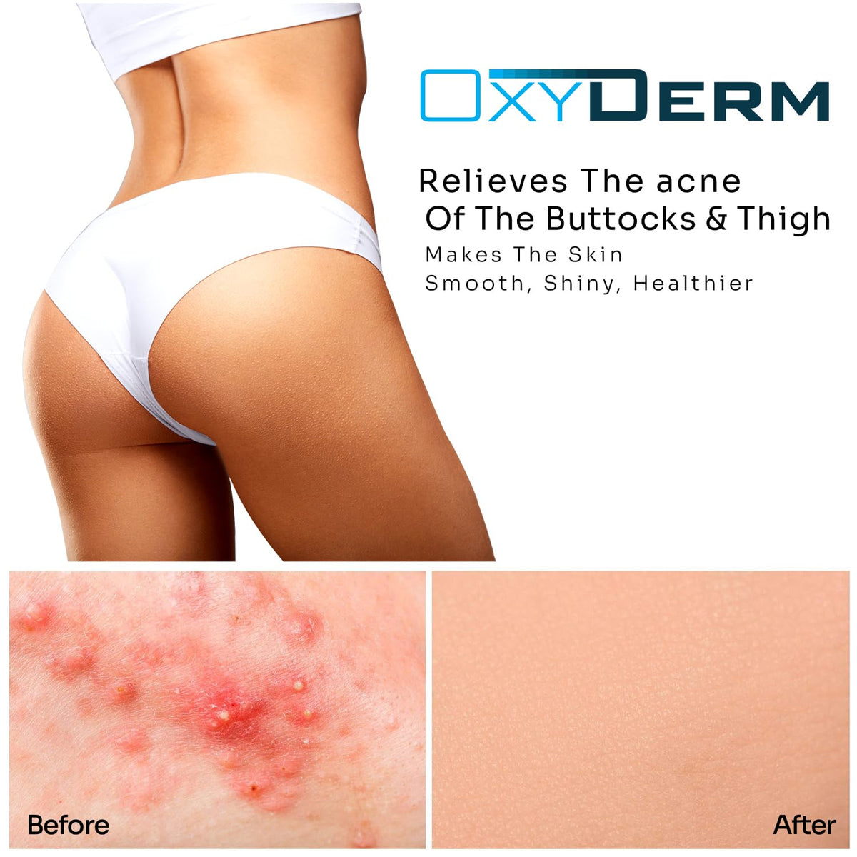 oxyderm ingredients label highlighting salicylic glycolic and lactic acids