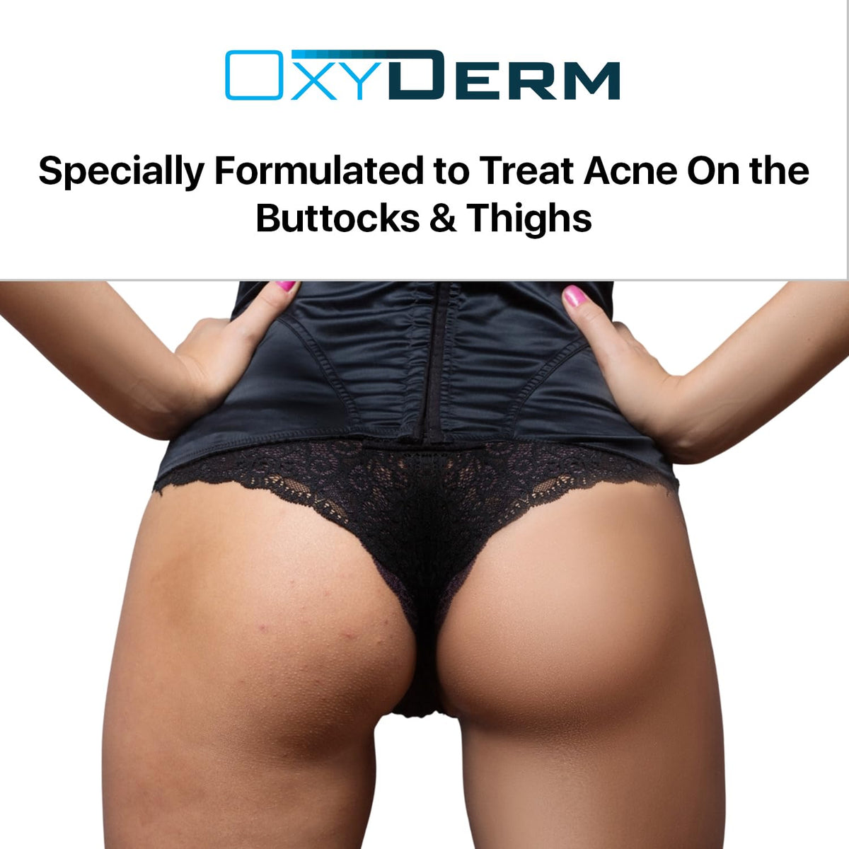 oxyderm pad applied on thigh to reduce bumps and unclog pores
