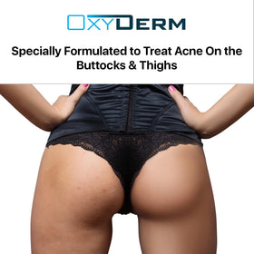 oxyderm pad applied on thigh to reduce bumps and unclog pores